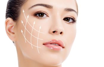 Facelift Procedure