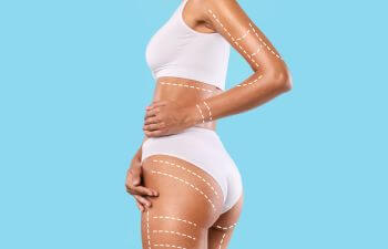 Body Liposuction