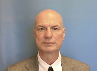 This gentleman had the following facelifting face lifting and neck lifting procedures