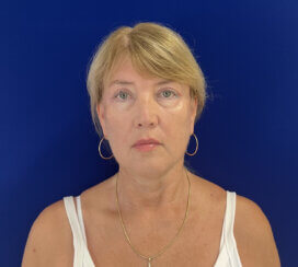 Facial Rejuvenation procedures.