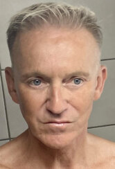 Endoscopic brow lift