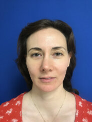 fat transfer to the following areas: under eyes, lips, chin and jawline.