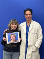 Revision facelift – Secondary facelift and associated face lifting procedures.